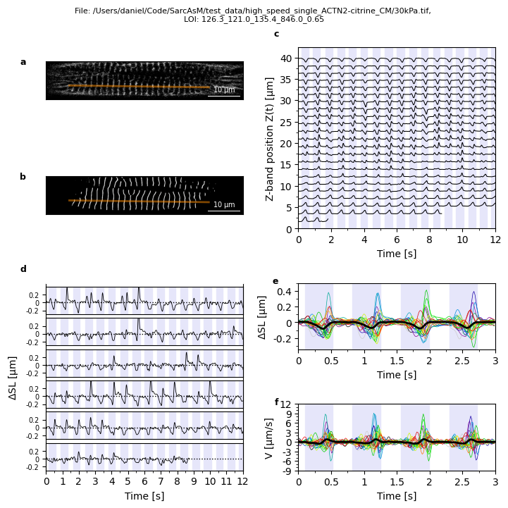 ../_images/notebooks_tutorial_motion_analysis_13_0.png