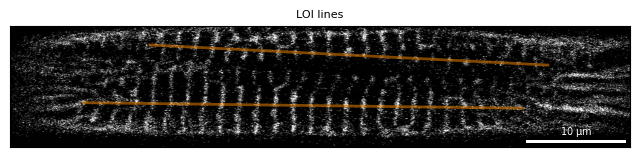 ../_images/notebooks_tutorial_motion_analysis_8_0.png