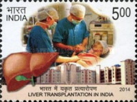 Liver Transplantation — 5.00R